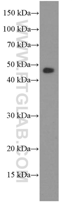 MAGEA3 Mouse anti-Human, Mouse, Porcine, Rat, Clone: 1A9F3, Proteintech