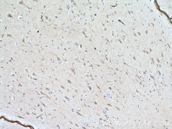 Syntaxin 6 Mouse anti-Human, Mouse, Rat, Clone: 2B6G4, Proteintech:Antibodies:Primary