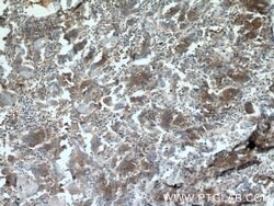 Syntaxin 6 Mouse anti-Human, Mouse, Rat, Clone: 2B6G4, Proteintech:Antibodies:Primary