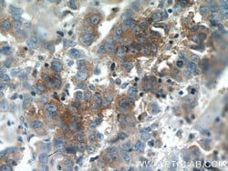 Syntaxin 6 Mouse anti-Human, Mouse, Rat, Clone: 2B6G4, Proteintech:Antibodies:Primary