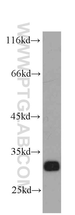 Syntaxin 6 Mouse anti-Human, Mouse, Rat, Clone: 2B6G4, Proteintech:Antibodies:Primary