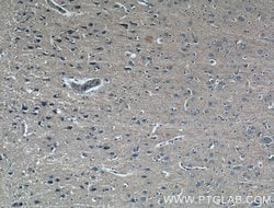 GMF-beta Mouse anti-Human, Porcine, Clone: 3B10A2, Proteintech 150 &mu;L | Buy Online | Proteintech Group Inc | Fisher Scientific