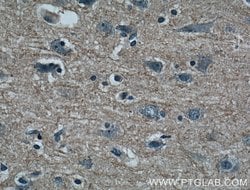 GMF-beta Mouse anti-Human, Porcine, Clone: 3B10A2, Proteintech 150 &mu;L | Buy Online | Proteintech Group Inc | Fisher Scientific