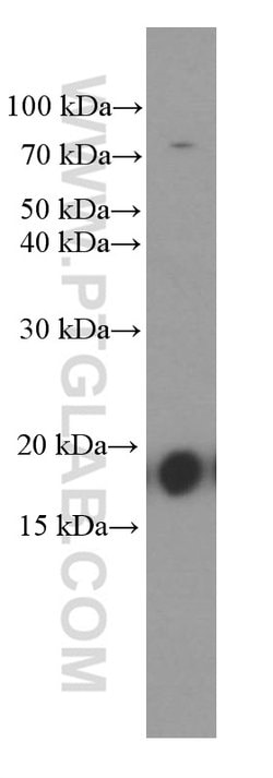 GMF-beta Mouse anti-Human, Porcine, Clone: 3B10A2, Proteintech 150 &mu;L | Buy Online | Proteintech Group Inc | Fisher Scientific
