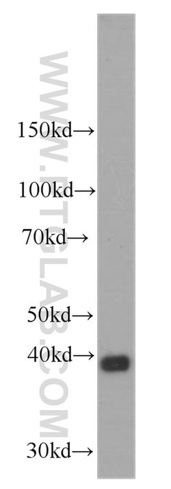 Stanniocalcin 2 Mouse anti-Human, Mouse, Clone: 4H1E7, Proteintech 150