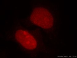 HDGF Mouse anti-Human, Mouse, Rat, Clone: 5A7G3, Proteintech 150 &mu;L;