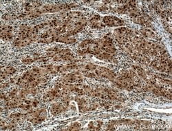HDGF Mouse anti-Human, Mouse, Rat, Clone: 5A7G3, Proteintech 150 &mu;L;