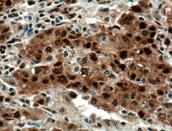 HDGF Mouse anti-Human, Mouse, Rat, Clone: 5A7G3, Proteintech 150 &mu;L;