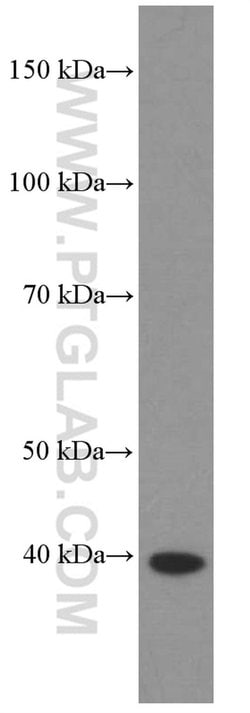 HDGF Mouse anti-Human, Mouse, Rat, Clone: 5A7G3, Proteintech 150 &mu;L;