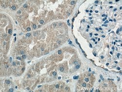 HDGF Mouse anti-Human, Mouse, Rat, Clone: 5A7G3, Proteintech 150 &mu;L;