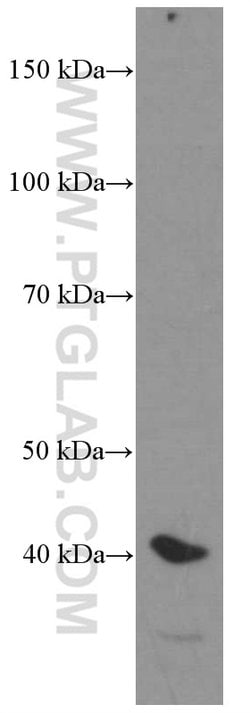 HDGF Mouse anti-Human, Mouse, Rat, Clone: 5A7G3, Proteintech 150 &mu;L;