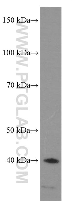 HDGF Mouse anti-Human, Mouse, Rat, Clone: 5A7G3, Proteintech 150 &mu;L;