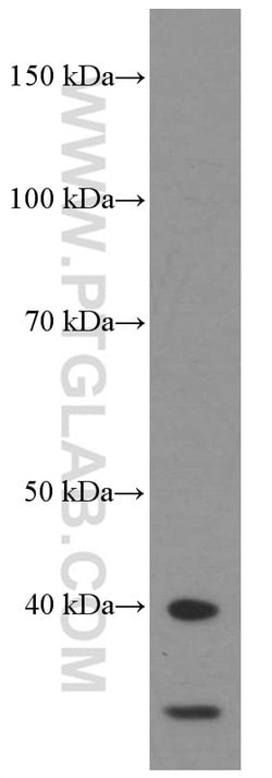HDGF Mouse anti-Human, Mouse, Rat, Clone: 5A7G3, Proteintech 150 &mu;L;