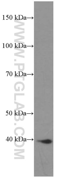 HDGF Mouse anti-Human, Mouse, Rat, Clone: 5A7G3, Proteintech 150 &mu;L;