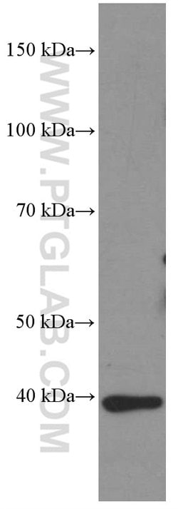 HDGF Mouse anti-Human, Mouse, Rat, Clone: 5A7G3, Proteintech 150 &mu;L;