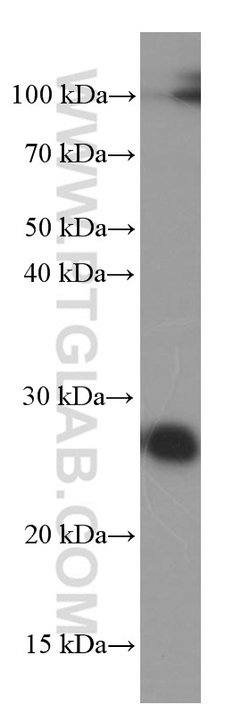 ERAB Mouse anti-Human, Mouse, Clone: 1G5E5, Proteintech:Antibodies:Primary