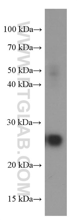 ERAB Mouse anti-Human, Mouse, Clone: 1G5E5, Proteintech:Antibodies:Primary