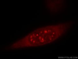 IL18 Mouse anti-Hamster, Human, Clone: 5C6F8, Proteintech:Antibodies:Primary