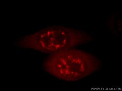 IL18 Mouse anti-Hamster, Human, Clone: 5C6F8, Proteintech:Antibodies:Primary