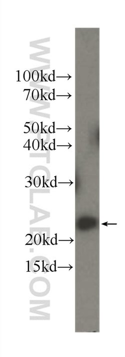 IL18 Mouse anti-Hamster, Human, Clone: 5C6F8, Proteintech:Antibodies:Primary