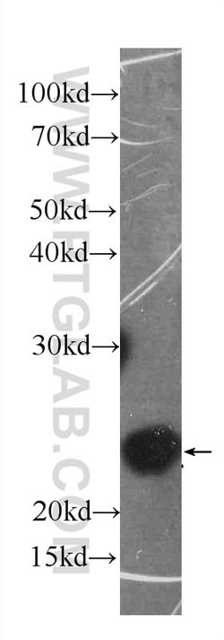 IL18 Mouse anti-Hamster, Human, Clone: 5C6F8, Proteintech:Antibodies:Primary