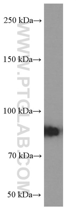 RRM1 Mouse anti-Human, Clone: 5H6F3, Proteintech
