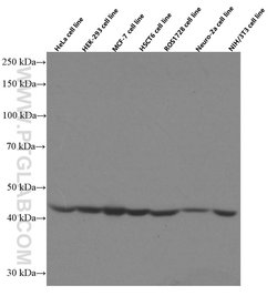SEPT2 Mouse anti-Human, Mouse, Rat, Clone: 2F3B2, Proteintech 20 &mu;L;