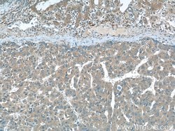 SEPT2 Mouse anti-Human, Mouse, Rat, Clone: 2F3B2, Proteintech 20 &mu;L;