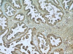 CTAGE1 Mouse anti-Human, Clone: 3B4C2, Proteintech 150 &mu;L | Buy Online | Proteintech Group Inc | Fisher Scientific