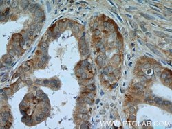 CTAGE1 Mouse anti-Human, Clone: 3B4C2, Proteintech 150 &mu;L | Buy Online | Proteintech Group Inc | Fisher Scientific