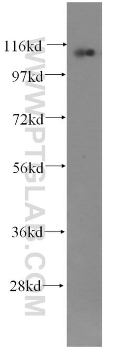 CTAGE1 Mouse anti-Human, Clone: 3B4C2, Proteintech 150 &mu;L | Buy Online | Proteintech Group Inc | Fisher Scientific