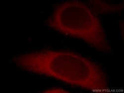 CTAGE1 Mouse anti-Human, Clone: 3B4C2, Proteintech 150 &mu;L | Buy Online | Proteintech Group Inc | Fisher Scientific