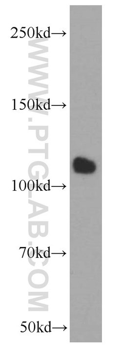 CTAGE1 Mouse anti-Human, Clone: 3B4C2, Proteintech 150 &mu;L | Buy Online | Proteintech Group Inc | Fisher Scientific