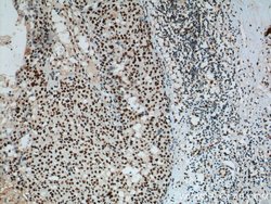 B23/NPM1 Mouse anti-Human, Mouse, Rat, Clone: 4F12A3, Proteintech:Antibodies:Primary