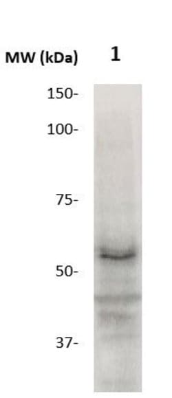 MMP-17 (MT4-MMP, MT-MMP-4) Polyclonal Antibody, Abbomax 100 &mu;g; Unconjugated:Antibodies,