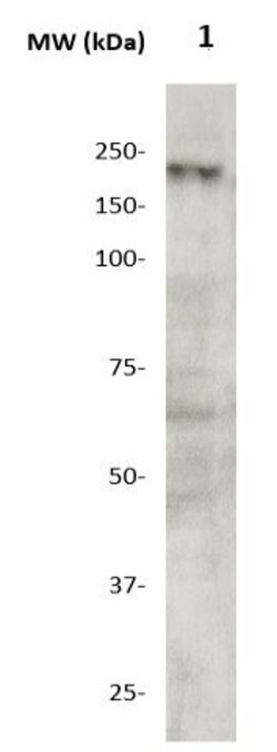 DCC Polyclonal Antibody, Abbomax 100 &mu;g; Unconjugated:Antibodies, Polyclonal