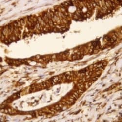 PDX-1 Polyclonal Antibody, Abbomax 100 &mu;g; Unconjugated:Antibodies,