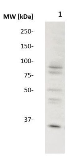 PDX-1 Polyclonal Antibody, Abbomax 100 &mu;g; Unconjugated:Antibodies,