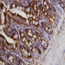 PCSK9 Polyclonal Antibody, Abbomax 100 &mu;g; Unconjugated:Antibodies,