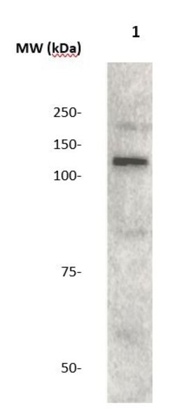 JAK2 Polyclonal Antibody, Abbomax 100 &mu;g; Unconjugated:Antibodies, Polyclonal