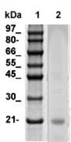 ANP (Atrial Natriuretic peptide)/BNP Polyclonal Antibody, Abbomax 100 &mu;g;