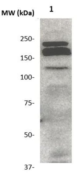 FLK-1 Polyclonal Antibody, Abbomax 100 &mu;g; Unconjugated:Antibodies,