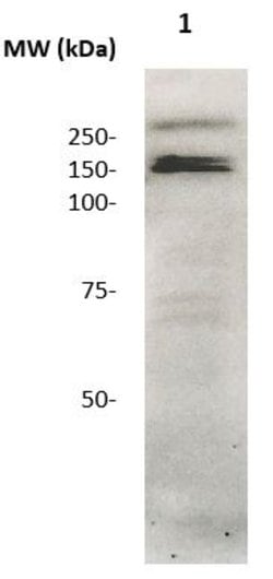CD136 (RON) Polyclonal Antibody, Abbomax 100 &mu;g | Buy Online | Abbomax Inc | Fisher Scientific