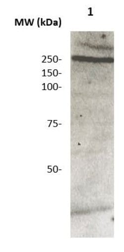 Coagulation Factor VIII (Fused form) Polyclonal Antibody, Abbomax 100 &mu;g;