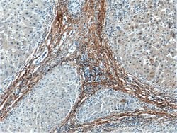 Fibromodulin Mouse anti-Human, Clone: 3E9D10, Proteintech:Antibodies:Primary
