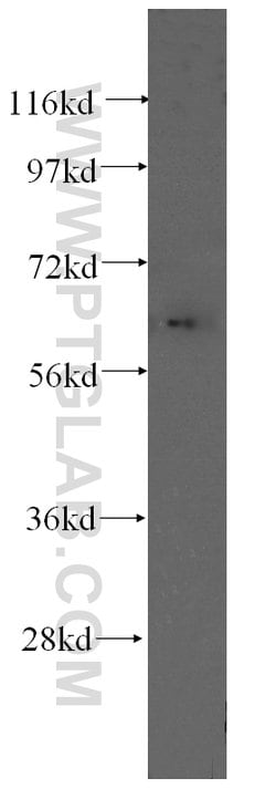 Fibromodulin Mouse anti-Human, Clone: 3E9D10, Proteintech:Antibodies:Primary