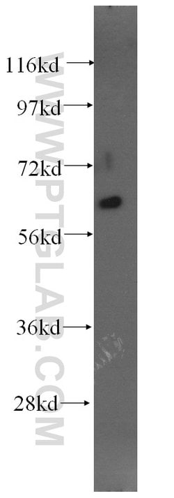 Fibromodulin Mouse anti-Human, Clone: 3E9D10, Proteintech:Antibodies:Primary