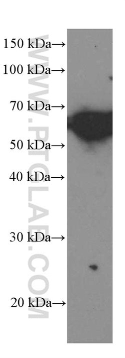ST2 Mouse anti-Human, Mouse, Porcine, Rat, Clone: 7A2A7, Proteintech 150