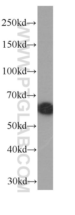 ST2 Mouse anti-Human, Mouse, Porcine, Rat, Clone: 7A2A7, Proteintech 150