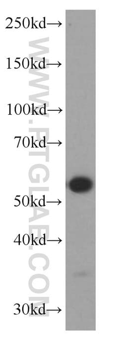 ST2 Mouse anti-Human, Mouse, Porcine, Rat, Clone: 7A2A7, Proteintech 150